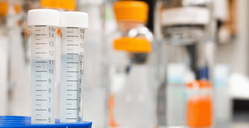 Provette urine: Strumenti indispensabili per l’analisi delle urine